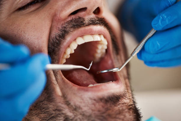 Best Wisdom Tooth Removal  in Morton Grove, IL